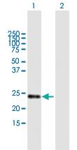 Anti-STARD5 Mouse Polyclonal Antibody