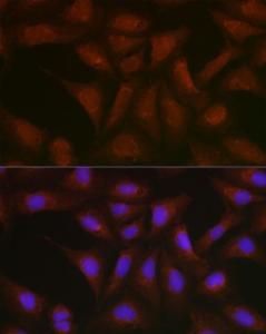 Immunofluorescence analysis of U2OS cells using Anti-BMPR1B Antibody (A309037) at a dilution of 1:200 (40x lens). DAPI was used to stain the cell nuclei (blue).