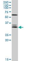 Anti-EFNA3 Rabbit Polyclonal Antibody