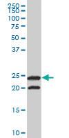 Anti-TPI1 Mouse Monoclonal Antibody [clone: 2C3]