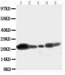 Anti-Caveolin-1 Rabbit Polyclonal Antibody