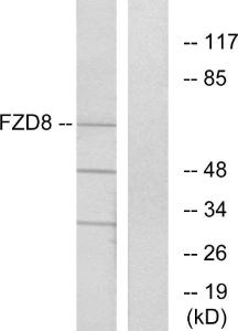 Western blot analysis of lysates from Jurkat cells using Anti-FZD8 Antibody. The right hand lane represents a negative control, where the antibody is blocked by the immunising peptide