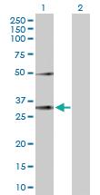 Anti-EFNA3 Rabbit Polyclonal Antibody