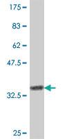 Anti-CD3G Mouse Polyclonal Antibody