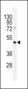 Anti-DNMT3L Rabbit Polyclonal Antibody (AP (Alkaline Phosphatase))