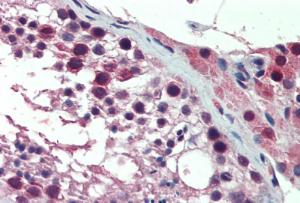 Anti-PREX1 Antibody (A84704) (10 µg/ml) staining of paraffin embedded Human Testis. Steamed antigen retrieval with citrate buffer pH 6, AP-staining