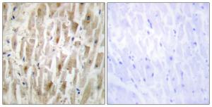 Immunohistochemical analysis of paraffin-embedded human heart tissue using Anti-LIMK2 Antibody. The right hand panel represents a negative control, where the antibody was pre-incubated with the immunising peptide