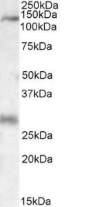 Anti-MAP3K6 Antibody (A84705) (0.3 µg/ml) staining of Rat Heart lysate (35 µg protein in RIPA buffer). Primary incubation was 1 hour. Detected by chemiluminescence