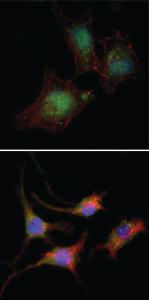 Anti-CTNNB1 Mouse Monoclonal Antibody [clone: 4D5]