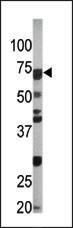 Anti-CDC6 Rabbit Polyclonal Antibody (HRP (Horseradish Peroxidase))