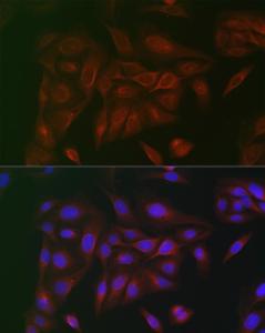 Immunofluorescence analysis of U2OS cells using Anti-CD130 Antibody (A92779) at a dilution of 1:100. DAPI was used to stain the cell nuclei (blue)