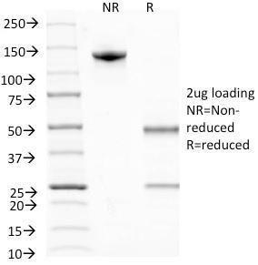 SDS-PAGE analysis of Anti-BrdU Antibody [MoBu-1] under non-reduced and reduced conditions; showing intact IgG and intact heavy and light chains, respectively SDS-PAGE analysis confirms the integrity and purity of the antibody