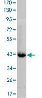 Anti-CTNNB1 Mouse Monoclonal Antibody [clone: 4D5]