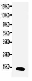 Anti-Estrogen Inducible Protein Ps2 Rabbit Polyclonal Antibody