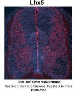 Anti-LHX5 Rabbit Polyclonal Antibody