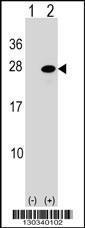 Anti-ATF3 Rabbit Polyclonal Antibody (AP (Alkaline Phosphatase))