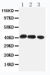 Anti-CCR4 Rabbit Polyclonal Antibody