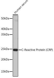 Western blot analysis of extracts of Human serum, using Anti-C Reactive Protein Antibody [ARC0341] (A309038) at 1:1,000 dilution. The secondary antibody was Goat Anti-Rabbit IgG H&L Antibody (HRP) at 1:10,000 dilution.