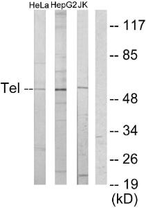 Western blot analysis of lysates from HeLa, HepG and Jurkat cells using Anti-ETV6 Antibody. The right hand lane represents a negative control, where the Antibody is blocked by the immunising peptide