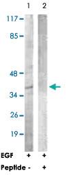 Anti-CEBPA Rabbit Polyclonal Antibody