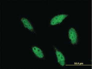 Anti-TBR1 Mouse Monoclonal Antibody [clone: 3F6]