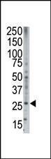 Anti-BOK Rabbit Polyclonal Antibody (APC (Allophycocyanin))