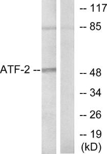 Western blot analysis of lysates from HeLa cells using Anti-ATF2 Antibody. The right hand lane represents a negative control, where the antibody is blocked by the immunising peptide