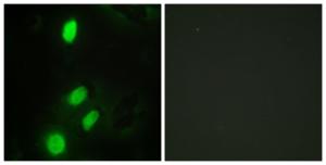 Immunofluorescence analysis of HeLa cells using Anti-ETV6 Antibody. The right hand panel represents a negative control, where the Antibody was pre-incubated with the immunising peptide