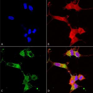 Immunocytochemistry/Immunofluorescence analysis of human neuroblastoma cells (SH-SY5Y), fixed in 4% PFA for 15 min, using Anti-NALCN Antibody [S187-7] (A304977), at 1:100 for overnight at 4°C with slow rocking