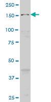 Anti-MAP3K5 Mouse Monoclonal Antibody [clone: 1E3]