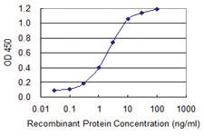 Anti-TBR1 Mouse Monoclonal Antibody [clone: 3F6]