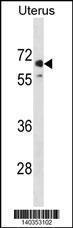 Anti-MMEL1 Rabbit Polyclonal Antibody (Biotin)