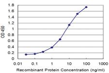 Anti-BMP5 Mouse Monoclonal Antibody [clone: 2C9]