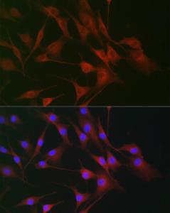 Immunofluorescence analysis of NIH/3T3 cells using Anti-CD130 Antibody (A92779) at a dilution of 1:100. DAPI was used to stain the cell nuclei (blue)