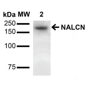 Western blot analysis of rat brain showing detection of ~200 kDa NALCN protein using Anti-NALCN Antibody [S187-7] (A304977) at 1:1,000 for 16 hours at 4°C Lane 1: Molecular Weight (MW) Ladder Lane 3: rat brain Membrane Load: 15  µg Block: 2% BSA and 2% Skim Milk in 1X TBST