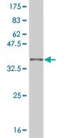 Anti-SIX3 Mouse Monoclonal Antibody [clone: 3D12]