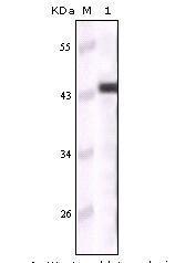 Anti-KRT5 Mouse Monoclonal Antibody