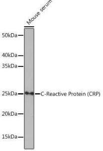 Western blot analysis of extracts of Mouse serum, using Anti-C Reactive Protein Antibody [ARC0341] (A309038) at 1:1,000 dilution. The secondary antibody was Goat Anti-Rabbit IgG H&L Antibody (HRP) at 1:10,000 dilution.