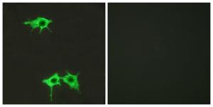 Immunofluorescence analysis of LOVO cells using Anti-FZD4 Antibody. The right hand panel represents a negative control, where the Antibody was pre-incubated with the immunising peptide