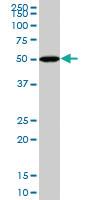 Anti-BMP5 Mouse Monoclonal Antibody [clone: 1G6]