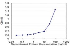 Anti-POLQ Mouse Monoclonal Antibody [clone: 1C11]