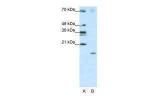 Anti-SRP19 Rabbit Polyclonal Antibody