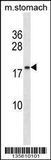 Anti-CACFD1 Rabbit Polyclonal Antibody (FITC (Fluorescein Isothiocyanate))