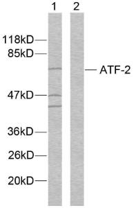 Western blot analysis of lysates from MDA-MB-435 cells using Anti-ATF2 Antibody. The right hand lane represents a negative control, where the antibody is blocked by the immunising peptide.