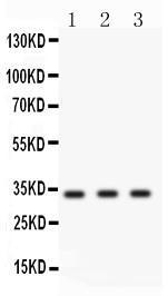 Anti-CCND1 Rabbit Polyclonal Antibody