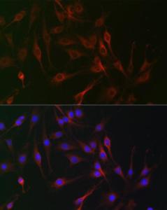 Immunofluorescence analysis of C6 cells using Anti-CD130 Antibody (A92779) at a dilution of 1:100. DAPI was used to stain the cell nuclei (blue)