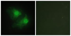 Immunofluorescence analysis of HeLa cells using Anti-LIMK2 Antibody. The right hand panel represents a negative control, where the antibody was pre-incubated with the immunising peptide