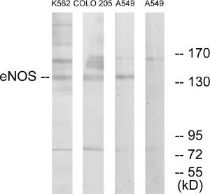 Western blot analysis of lysates from A549, K56 and COLO205 cells using Anti-eNOS Antibody. The right hand lane represents a negative control, where the antibody is blocked by the immunising peptide