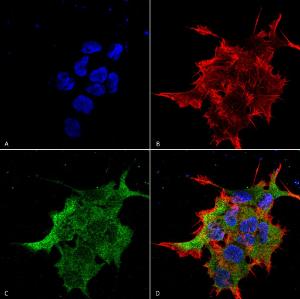 Immunocytochemistry/Immunofluorescence analysis of human neuroblastoma cell line (SK-N-BE, fixed in 4% formaldehyde for 15 min at room temperature, using Anti-NALCN Antibody [S187-7] (A304977), at 1:100 for 60 minutes at room temperature