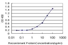 Anti-MAP3K5 Mouse Monoclonal Antibody [clone: 1E3]